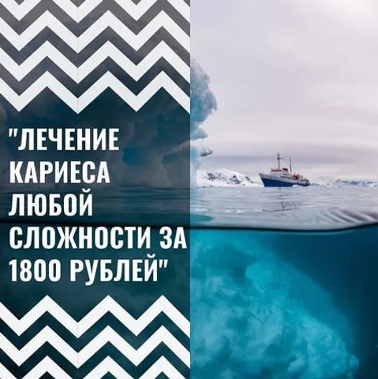 Лечение кариеса любой сложности за 1800 рублей: что скрывается под вершиной айсберга?